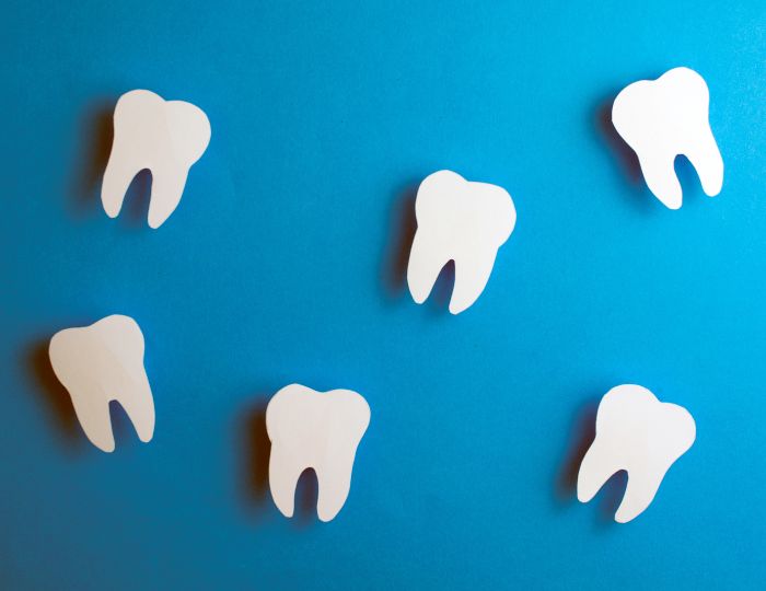 インプラント本数を抑える