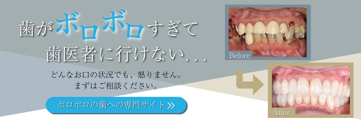 バナー